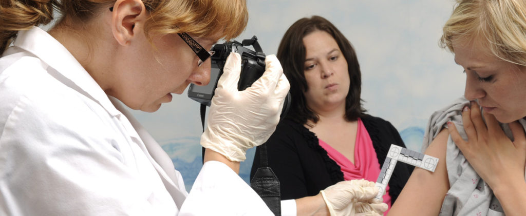 sexual assault, SANE