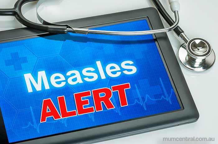 measles, tacoma–pierce county health department, seattle king-county health department,