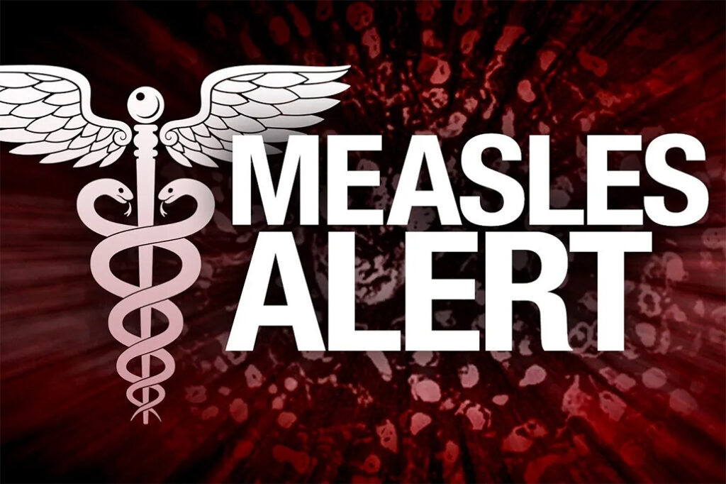 king county measles, measles, mealses outbreak, vaccinate, plague