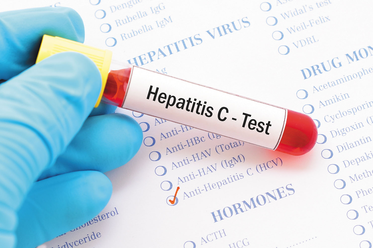hep c, blood sample, hepatitis c
