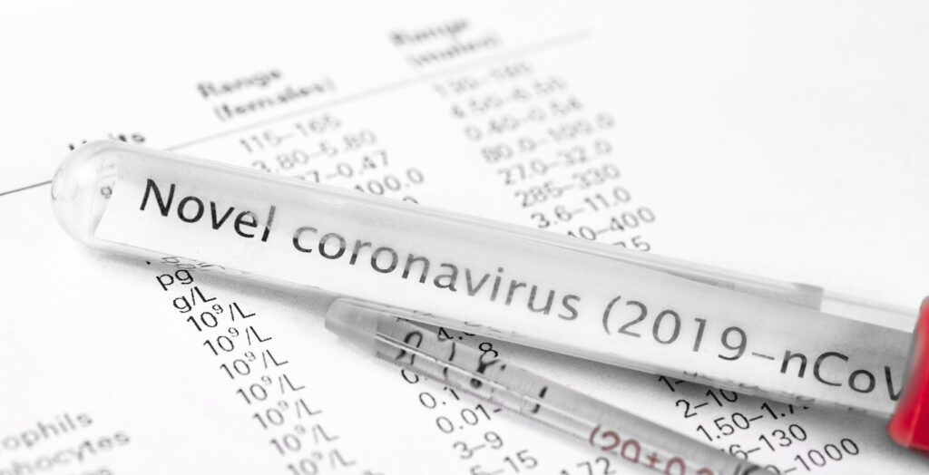 coronavirus, novel coronavirus, 2019 n-cov, wuhan coronavirus, what is the coronavirus, what is the 2019 novel coronavirus, can i get the coronavirus
